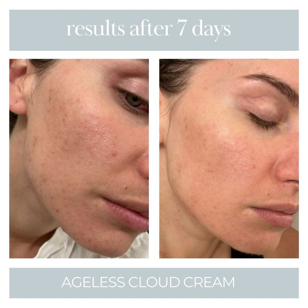 Ageless Cloud Cream - 3pk