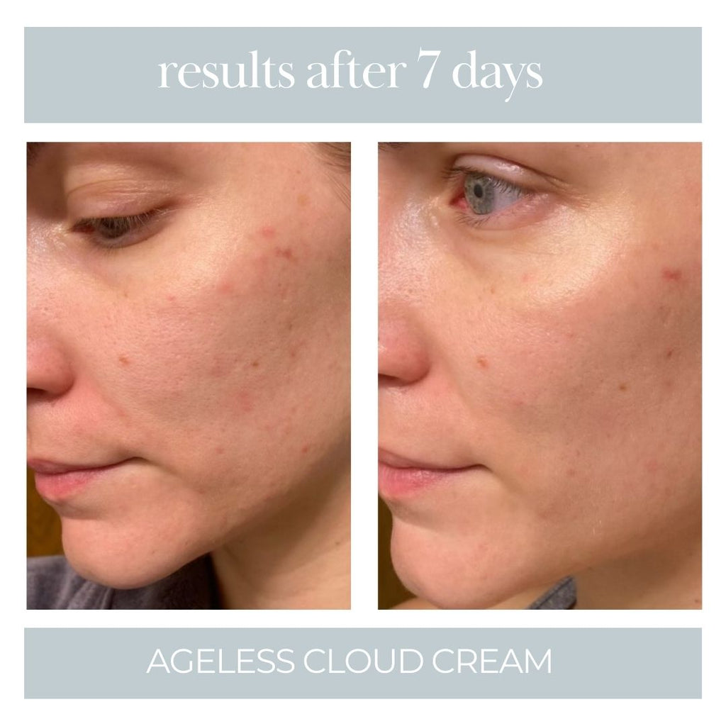 Ageless Cloud Cream - 3pk