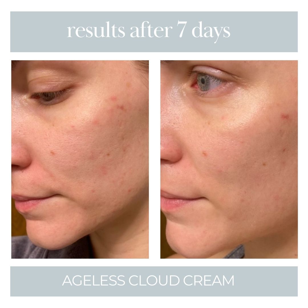 Ageless Cloud Cream - 3pk