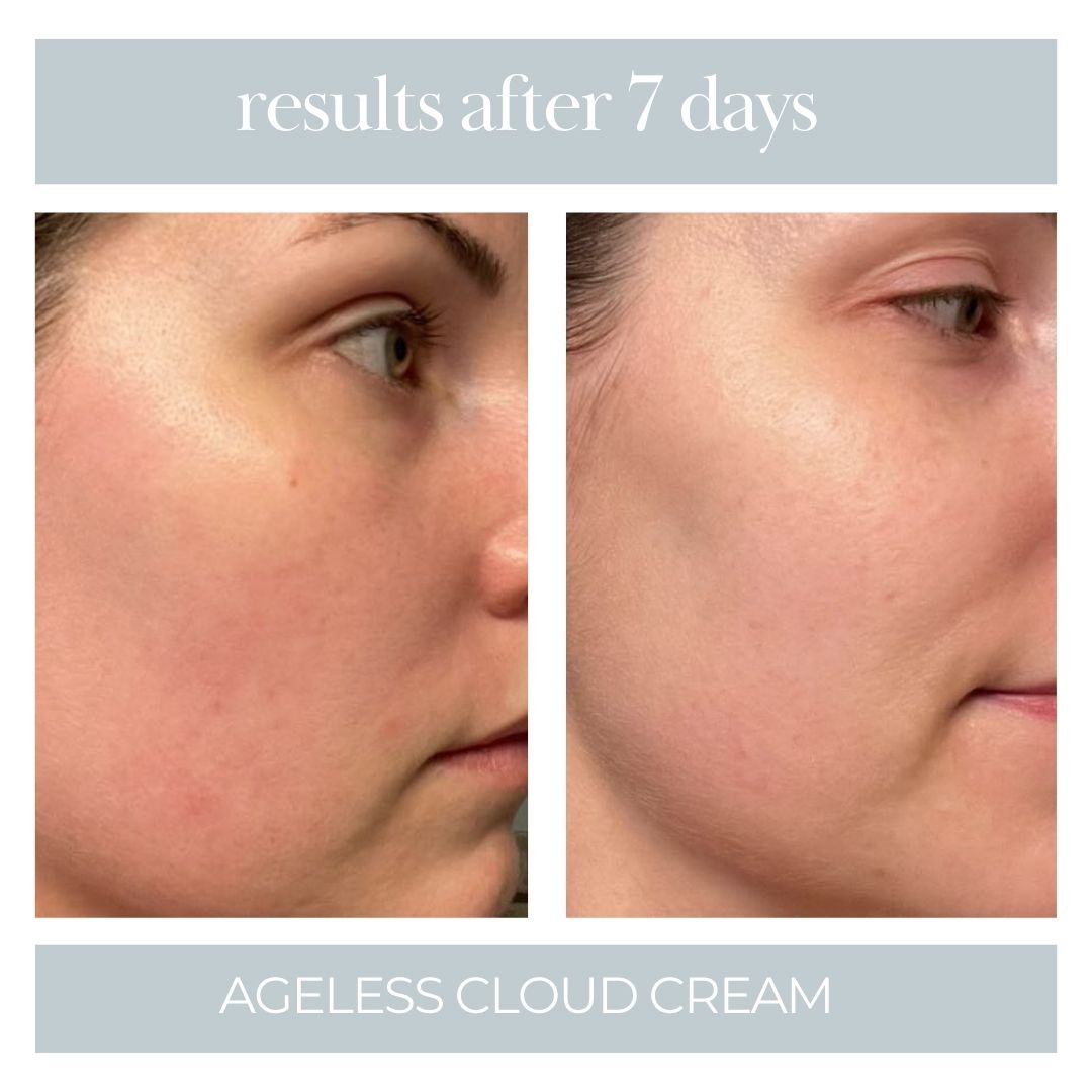 Ageless Cloud Cream - 3pk