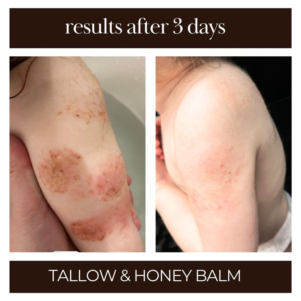 Tallow & Honey Balm