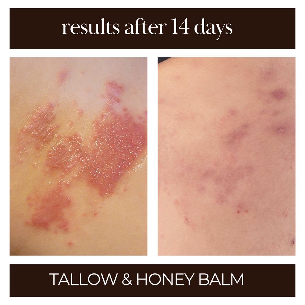 Tallow and Honey Balm - 3pk