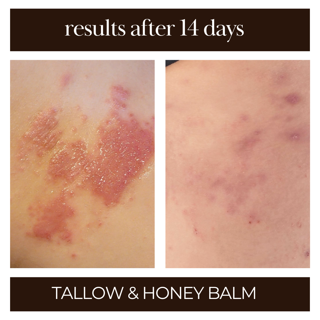 Tallow and Honey Balm - 3pk