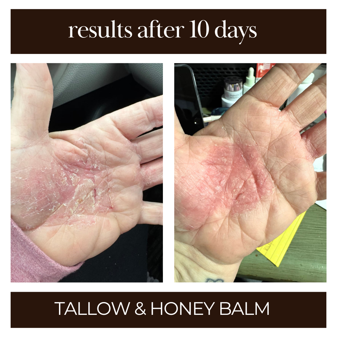 Tallow and Honey Balm - 3pk