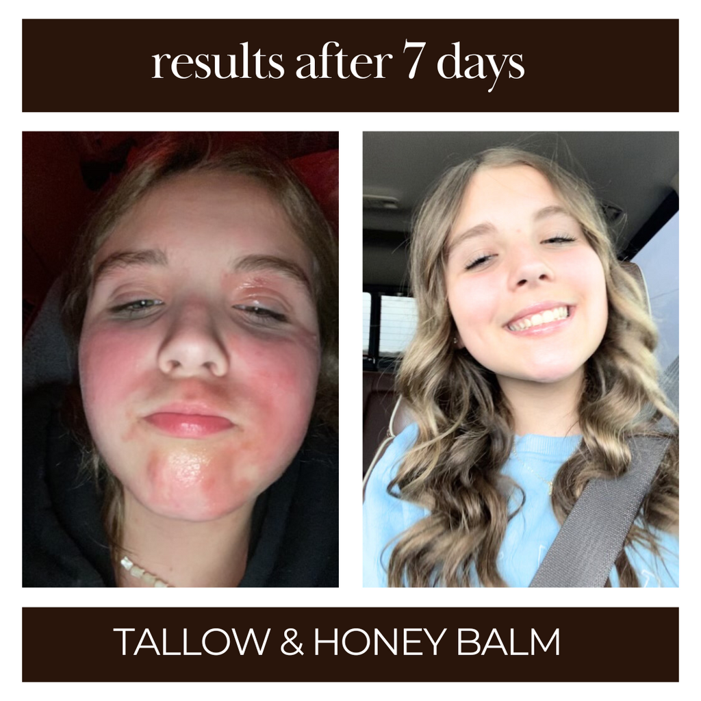 Tallow and Honey Balm - 3pk