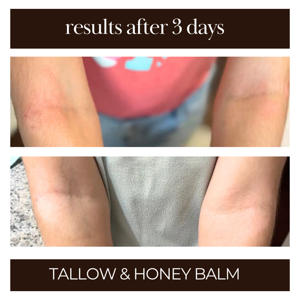 Tallow and Honey Balm - 3pk
